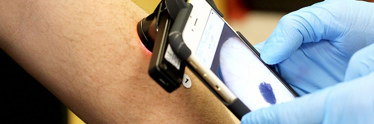 Clinical photographer taking a digital photograph of a skin lesion